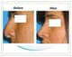 Slider image (5) Aesthetic Cosmetic Plastic Surgery Center Bolivia - SensualBodyDream